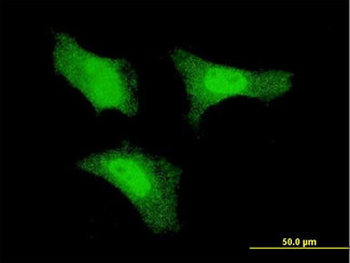 FGF1/Acidic FGF Antibody