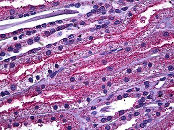 ABCC4/MRP4 Antibody