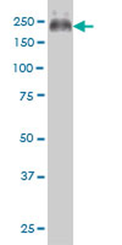 ABCC4/MRP4 Antibody