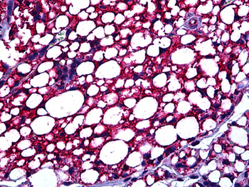TSPO/PBR Antibody