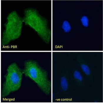 TSPO/PBR Antibody