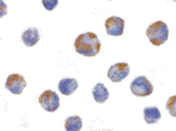 NALP1/NLRP1 Antibody