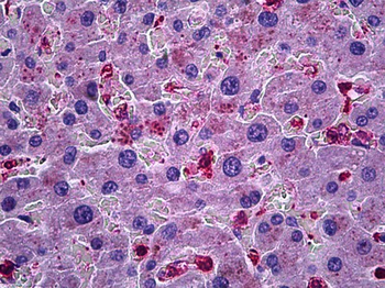 CCL20/MIP-3-Alpha Antibody