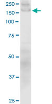 COL1A1/Collagen I Alpha 1 Antibody