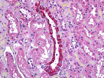 TGFBI Antibody
