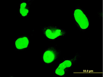 STAT6 Antibody