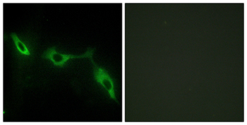 LGALS9/Galectin 9 Antibody