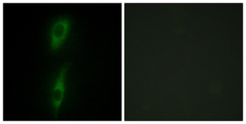 ACVRL1 Antibody