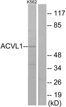 ACVRL1 Antibody