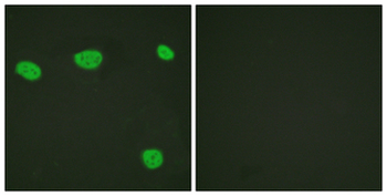 Vitamin D Receptor/VDR Antibody
