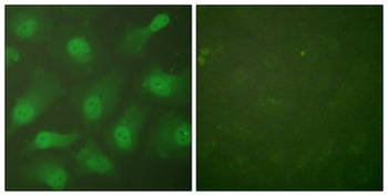 CSE1L Antibody