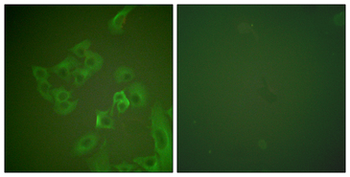 SNCB/Beta-Synuclein Antibody