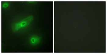 TNFSF13/APRIL Antibody