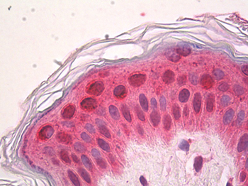 SETD7/SET7 Antibody