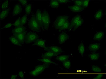 SETD7/SET7 Antibody