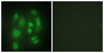 SYNCRIP/HnRNP Q Antibody