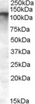 ABCC11/MRP8 Antibody