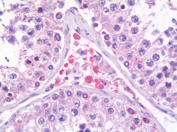 PRICKLE2 Antibody
