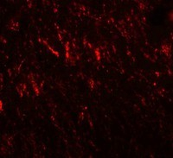 PRICKLE2 Antibody