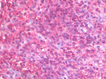 BTLA/CD272 Antibody