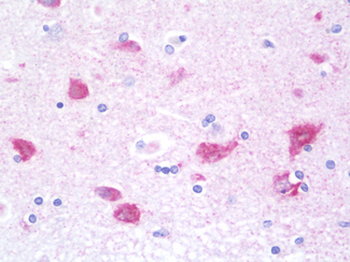 G3BP2 Antibody
