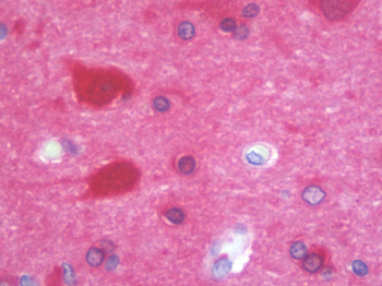 MAPRE2/EB2 Antibody
