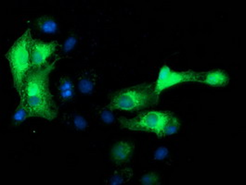 MAPRE2/EB2 Antibody