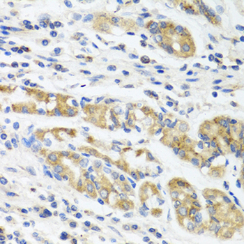 IL11 Antibody (aa22-199)