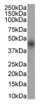 Anti-CD25 [2E4]