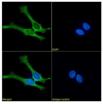 Anti-Mesothelin [IC14-30]
