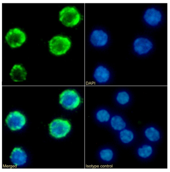 Anti-IFN-gamma receptor 1 [GR20]