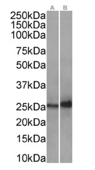 Anti-HSPB1 [SAIC-23B-22]