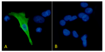 Anti-Protein C [HPC-4]