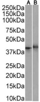 Anti-4-1BB [BBK4 ]