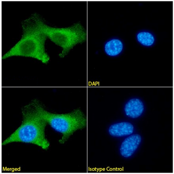 Anti-Nerve growth factor [mab 911]