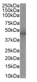 Anti-CD25 [7G7/B6]