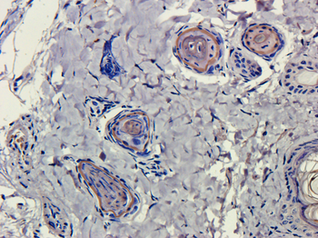 Anti-CD4 [MT310]