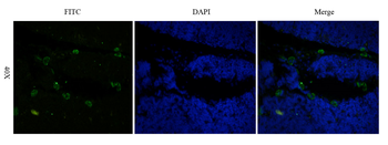 Anti-CD52 [Alemtuzumab (Campath-1H)]