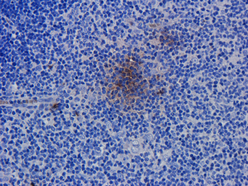 Anti-CD52 [Alemtuzumab (Campath-1H)]