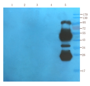 Anti-IL-2R [Daclizumab]