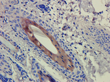 Anti-CD4 [CE9.1 (Clenoliximab)]