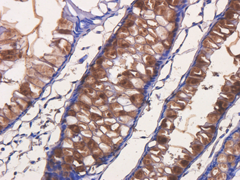 Anti-Tumor associated glycoprotein (TAG) 72 [B72.3 (Satumomab)]