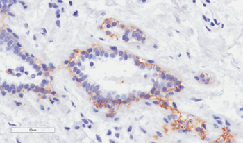 Trastuzumab Biosimilar Antibody, Research Grade (Anti-Her2 / ErbB2)