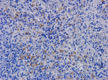 Anti-CD11a [hu1124 (Efalizumab)]