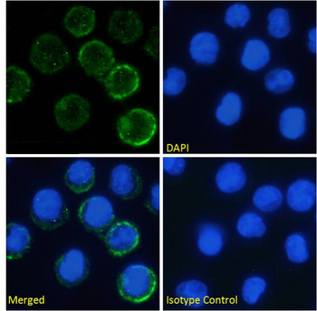 Anti-IL-6 receptor [rhPM-1 (Tocilizumab)]