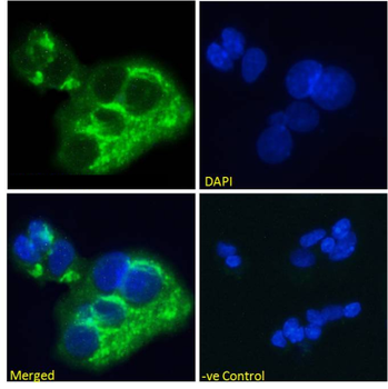 Anti-Alpha-fetoprotein (AFP) [AF5]