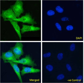 Anti-Fibronectin [G4]