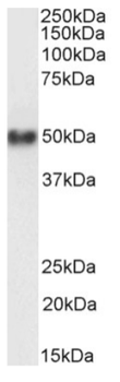 Anti-CD38 [AT13/5]