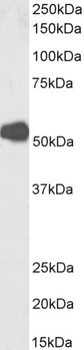 Anti-Human Muscle Acetylcholine Receptor [mAb 192]