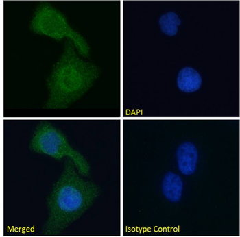 Mouse Monoclonal Antibody to Cardiac Troponin I
